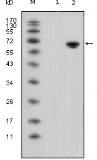 WNT5A Primary Antibody MP20330 [M6F2]