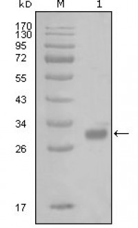 PAR1 Primary Antibody MP20262 [M6A7H10]