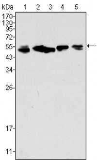 Cytokeratin 8 Primary Antibody MP20280 [M8A5D12]
