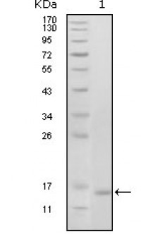 EhpB6 Primary Antibody MP20183 [M2A6B9]