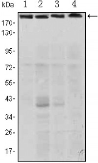 RICTOR Primary Antibody MP30093 [M4H5]