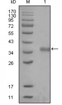 NCOR1 Primary Antibody MP20265 [M7A7A9]