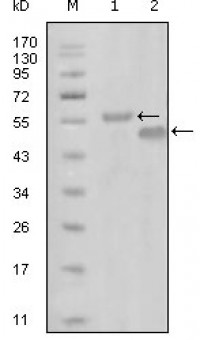 EphA6 Primary Antibody MP20288 [M3D5B10]