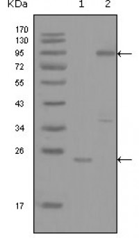 YES1 Primary Antibody MP20185 [M2F3E6]