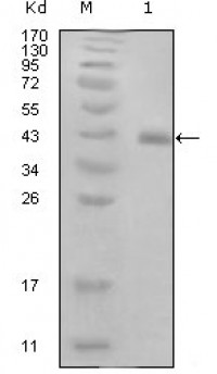 E7 Primary Antibody MP20256 [M3D6F1]