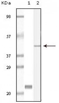 CIB1 Primary Antibody MP20087 [M5A1F5E12]