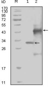 EphA4 Primary Antibody MP20220 [M7D3D4]