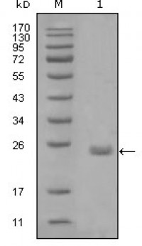 AXL Primary Antibody MP20250 [M1B3A2]