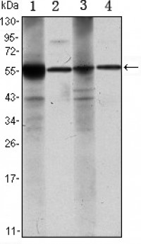 ALDH1A1 Primary Antibody MP30102 [M5A11]