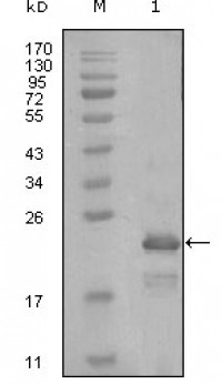 HAND1 Primary Antibody MP20253 [M8E7A11]