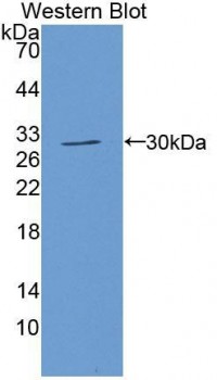 Anti-BCHE / Cholinesterase Antibody (aa345-570) MX-C372947