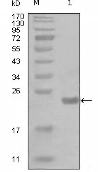 CHUK Primary Antibody MP20240 [M7C10B6]