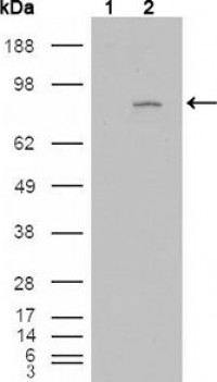 FGFR4 Primary Antibody MP20145 [M4H2B10B2]