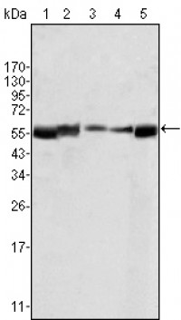 LYN Primary Antibody MP20123 [M2H8D7]
