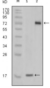 STYK1 Primary Antibody MP20168 [M2H2F10]