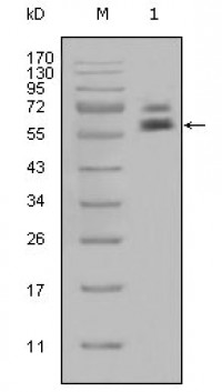 Cytokeratin 5 Primary Antibody MP20322 [M1E1]
