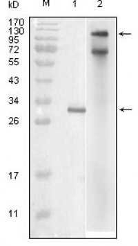 IKBKE Primary Antibody MP20174 [M6B4B5]