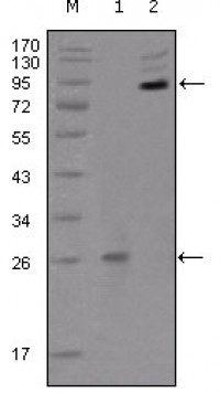 EphB2 Primary Antibody MP20199 [M2D12C6]