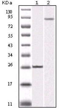 IKBKB Primary Antibody MP20113 [M10A2]