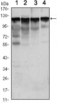 HK1 Primary Antibody MP30089 [M3A10]