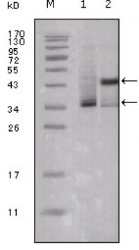 ESR1 Primary Antibody MP20206 [M10H12B10]
