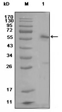 ESR1 Primary Antibody MP20284 [M2G112B3]