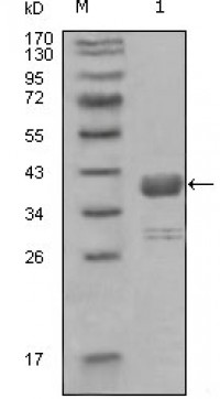 ABL1 Primary Antibody MP20244 [M7B11D6]
