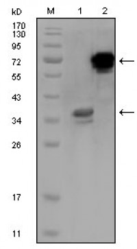 HPS1 Primary Antibody MP20180 [M5G12G2]
