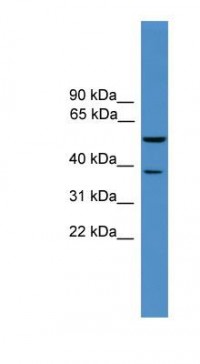 Anti-BACE1 / BACE Antibody (aa251-300) MX-C116864