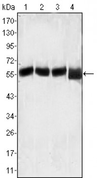 Lck Primary Antibody MP20083 [M8E5F9]