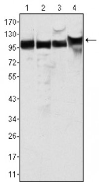 MSH2 Primary Antibody MP20025 [M1B3A8A8]