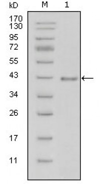LAMB1 Primary Antibody MP20287 [M2D9G5]