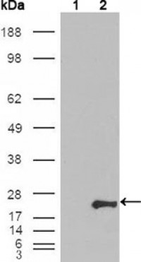 GSTP1 Primary Antibody MP20099 [M3F2C2]