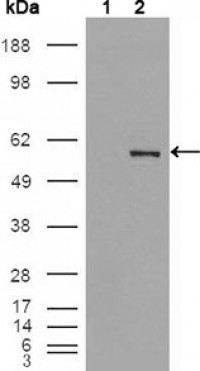 ETV4 Primary Antibody MP20236 [M1A2G3]