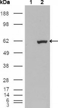 ETV1 Primary Antibody MP20281 [M1C8B6]