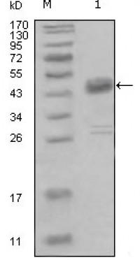DDR1 Primary Antibody MP20242 [M2G4E12]