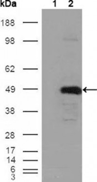 BHMT Primary Antibody MP20285 [M8C11H5]