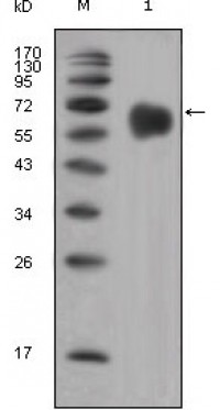 FGFR4 Primary Antibody MP20328 [M7H1]
