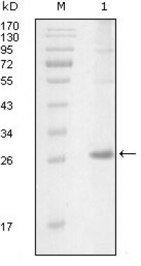 ITK Primary Antibody MP20215 [M5G12C4]