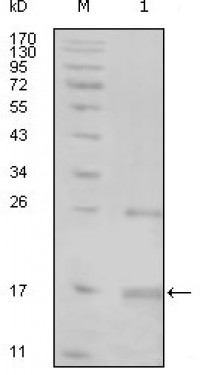TNK1 Primary Antibody MP20219 [M1B5G3]