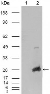 CRYAB Primary Antibody MP20182 [M1D11C6E6]