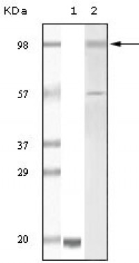 Tyro3 Primary Antibody MP20082 [M7A10C11; 7A10G4]