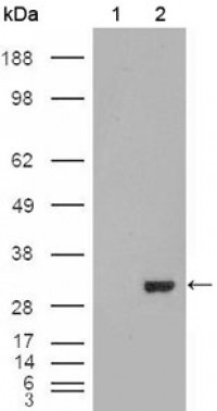 CA1 Primary Antibody MP20225 [M9D6D7]