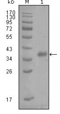 FABP4 Primary Antibody MP20249 [M5H11A4E11]