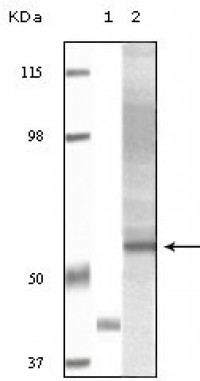 Akt3 Primary Antibody MP20078 [M3B12F3F10; 2D2B11B11; 2D2B11H5]