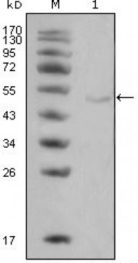 LPL Primary Antibody MP20331 [M2C5]