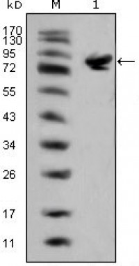 ISL1 Primary Antibody MP20344 [M1H9]