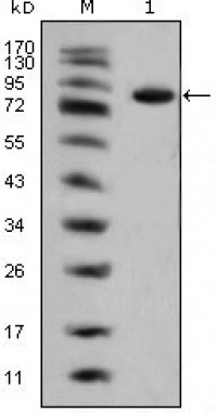 ISL1 Primary Antibody MP20345 [M1B1]
