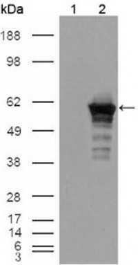 Desmin Primary Antibody MP20094 [M10H7D2]