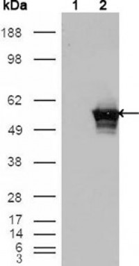 GABPA Primary Antibody MP20227 [M8C1B10]